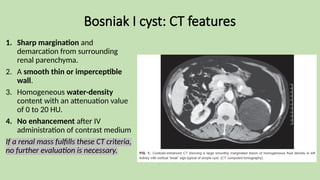 Bosniak I cyst: CT features
1. Sharp margination and
demarcation from surrounding
renal parenchyma.
2. A smooth thin or imperceptible
wall.
3. Homogeneous water-density
content with an attenuation value
of 0 to 20 HU.
4. No enhancement after IV
administration of contrast medium
If a renal mass fulfills these CT criteria,
no further evaluation is necessary.
 