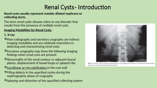 Renal Cysts- Introduction
Renal cysts usually represent notably dilated nephrons or
collecting ducts.
The term renal cystic disease refers to any disorder that
results from the presence of multiple renal cysts.
Imaging Modalities for Renal Cysts:
1. X-ray:
Plain radiography and excretory urography are indirect
imaging modalities and are relatively insensitive in
detecting and characterizing renal cysts.
Excretory urography may show the following imaging
findings when renal cysts are present:
Abnormality of the renal contour or adjacent fascial
planes, displacement of bowel loops or splayed ribs
Curvilinear or rim calcification in the cyst wall
Filling defects in the opacified cortex during the
nephrographic phase of urography
Splaying and distortion of the opacified collecting system
 