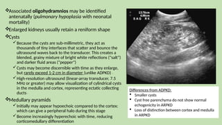 Associated oligohydramnios may be identified
antenatally (pulmonary hypoplasia with neonatal
mortality)
Enlarged kidneys usually retain a reniform shape
Cysts
Because the cysts are sub-millimetric, they act as
thousands of tiny interfaces that scatter and bounce the
ultrasound waves back to the transducer. This creates a
blended, grainy mixture of bright white reflections ("salt")
and darker fluid areas ("pepper")
Cysts may become discernible with time as they enlarge,
but rarely exceed 1-2 cm in diameter (unlike ADPKD) 13
High-resolution ultrasound (linear-array transducer, 7.5
MHz or greater) may allow visualization of cylindrical cysts
in the medulla and cortex, representing ectatic collecting
ducts 8
Medullary pyramids
Initially may appear hypoechoic compared to the cortex:
which can give a peripheral halo during this stage
Become increasingly hyperechoic with time, reducing
corticomedullary differentiation
Differences from ADPKD:
 Smaller cysts
 Cyst free parenchyma do not show normal
echogenicity in ARPKD
 Loss of distinction between cortex and medulla
in ARPKD
 