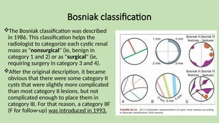 Bosniak classification
The Bosniak classification was described
in 1986. This classification helps the
radiologist to categorize each cystic renal
mass as "nonsurgical" (ie, benign in
category 1 and 2) or as "surgical" (ie,
requiring surgery in category 3 and 4).
After the original description, it became
obvious that there were some category II
cysts that were slightly more complicated
than most category II lesions, but not
complicated enough to place them in
category III. For that reason, a category IIF
(F for follow-up) was introduced in 1993.
 