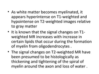 • As white matter becomes myelinated, it
appears hyperintense on T1-weighted and
hypointense on T2-weighted images relative
to gray matter
• It is known that the signal changes on T1-
weighted MR increases with increase in
certain lipids that occur during the formation
of myelin from oligodendrocytes .
• The signal changes on T2-weighted MR have
been presumed to be histologically as
thickening and tightening of the spiral of
myelin around the axon and loss of water .
 