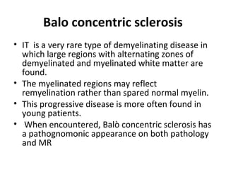 Balo concentric sclerosis
• IT is a very rare type of demyelinating disease in
which large regions with alternating zones of
demyelinated and myelinated white matter are
found.
• The myelinated regions may reflect
remyelination rather than spared normal myelin.
• This progressive disease is more often found in
young patients.
• When encountered, Balò concentric sclerosis has
a pathognomonic appearance on both pathology
and MR
 