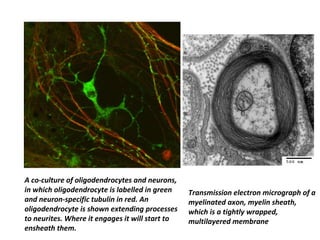 A co-culture of oligodendrocytes and neurons,
in which oligodendrocyte is labelled in green
and neuron-specific tubulin in red. An
oligodendrocyte is shown extending processes
to neurites. Where it engages it will start to
ensheath them.
Transmission electron micrograph of a
myelinated axon, myelin sheath,
which is a tightly wrapped,
multilayered membrane
 