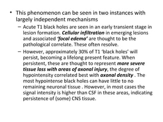 • This phenomenon can be seen in two instances with
largely independent mechanisms
– Acute T1 black holes are seen in an early transient stage in
lesion formation. Cellular infiltration in emerging lesions
and associated ‘focal edema’ are thought to be the
pathological correlate. These often resolve.
– However, approximately 30% of T1 ‘black holes’ will
persist, becoming a lifelong present feature. When
persistent, these are thought to represent more severe
tissue loss with areas of axonal injury, the degree of
hypointensity correlated best with axonal density . The
most hypointense black holes can have little to no
remaining neuronal tissue . However, in most cases the
signal intensity is higher than CSF in these areas, indicating
persistence of (some) CNS tissue.
 