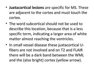 • Juxtacortical lesions are specific for MS. These
are adjacent to the cortex and must touch the
cortex.
• The word subcortical should not be used to
describe this location, because that is a less
specific term, indicating a larger area of white
matter almost reaching the ventricles.
• In small vessel disease these juxtacortical U-
fibers are not involved and on T2 and FLAIR
there will be a dark band between the WML
and the (also bright) cortex (yellow arrow).
 