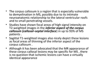 • The corpus callosum is a region that is especially vulnerable
to demyelination in MS, possibly due to its intimate
neuroanatomic relationship to the lateral ventricular roofs
and to small penetrating vessels.
• Studies have shown focal areas of high signal intensity on
T2-weighted images in the inferior aspect of the corpus
callosum (callosal–septal interface) in up to 93% of MS
patients .
• Sagittal T1-weighted images also nicely depict these lesions
as focal areas of thinning of the inferior aspect of the
corpus callosum .
• Although it has been advocated that the MR appearance of
these corpus callosal lesions may be specific for MS , there
is no question that ischemic lesions can have a virtually
identical appearance
 