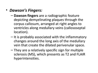 • Dawson’s Fingers:
– Dawson fingers are a radiographic feature 
depicting demyelinating plaques through the 
corpus callosum, arranged at right angles to 
ventricles along medullary veins (callososeptal 
location).
– It is probably associated with the inflammatory 
changes around the long axis of the medullary 
vein that create the dilated perivenular space.
– They are a relatively specific sign for multiple 
sclerosis (MS), which presents as T2 and FLAIR 
hyperintensities.
 