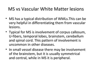 MS vs Vascular White Matter lesions
• MS has a typical distribution of WMLs.This can be 
very helpful in differentiating them from vascular 
lesions.
• Typical for MS is involvement of corpus callosum, 
U-fibers, temporal lobes, brainstem, cerebellum 
and spinal cord. This pattern of involvement is 
uncommon in other diseases.
• In small vessel disease there may be involvement 
of the brainstem, but it is usually symmetrical 
and central, while in MS it is peripheral.
 