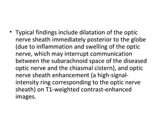 • Typical findings include dilatation of the optic 
nerve sheath immediately posterior to the globe 
(due to inflammation and swelling of the optic 
nerve, which may interrupt communication 
between the subarachnoid space of the diseased 
optic nerve and the chiasmal cistern), and optic 
nerve sheath enhancement (a high-signal-
intensity ring corresponding to the optic nerve 
sheath) on T1-weighted contrast-enhanced 
images.
 