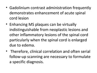 • Gadolinium contrast administration frequently 
demonstrates enhancement of acute spinal 
cord lesion
• Enhancing MS plaques can be virtually 
indistinguishable from neoplastic lesions and 
other inflammatory lesions of the spinal cord 
particularly when the spinal cord is enlarged 
due to edema.
•  Therefore, clinical correlation and often serial 
follow-up scanning are necessary to formulate 
a specific diagnosis.
 