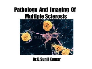 Pathology And Imaging Of
Multiple Sclerosis
Dr.D.Sunil Kumar
 