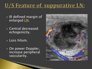  Ill defined margin of
enlarged LN.
 Central decreased
echogenicity.
 Loss hilum.
 On power Doppler,
increase peripheral
vascularity.
 