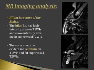  Hilum Structure of the
Nodes:
 The hilar fat, has high-
intensity area on T1WIs
and a low-intensity area
on fat suppressedT2WIs.
 The vessels may be
evident in the hilum on
T1WIs and fat suppressed
T2WIs.
 