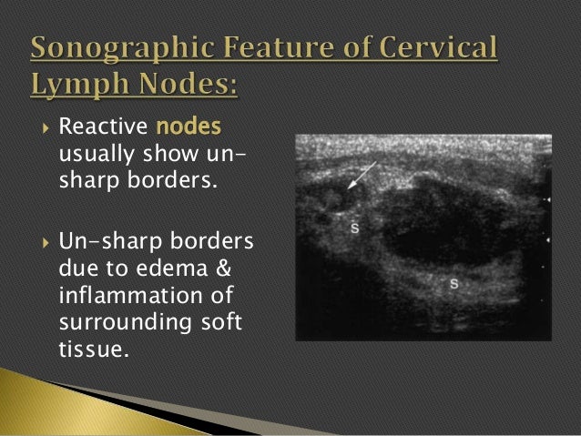 Imaging of enlarged lymph node