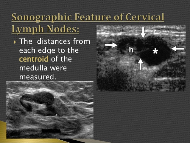 Imaging Of Enlarged Lymph Node