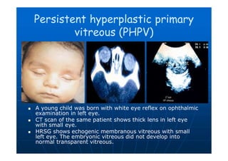 Pphpv Eye Imaging of eye and orbit | PDF