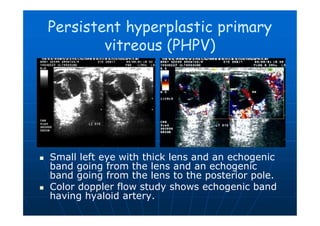 Pphpv Eye Imaging of eye and orbit | PDF