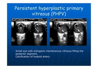 Pphpv Eye Imaging of eye and orbit | PDF