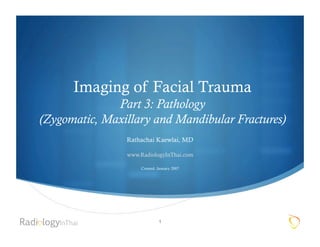 Imaging of Facial Trauma
              Part 3: Pathology
(Zygomatic, Maxillary and Mandibular Fractures)
                Rathachai Kaewlai, MD

                www.RadiologyInThai.com

                    Created: January 2007




                             1
 