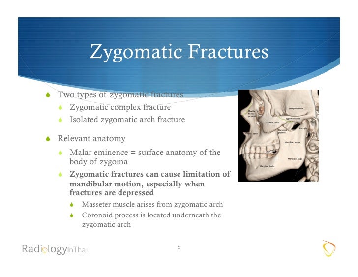 Imaging Of Facial Trauma Part 3 (2) 2