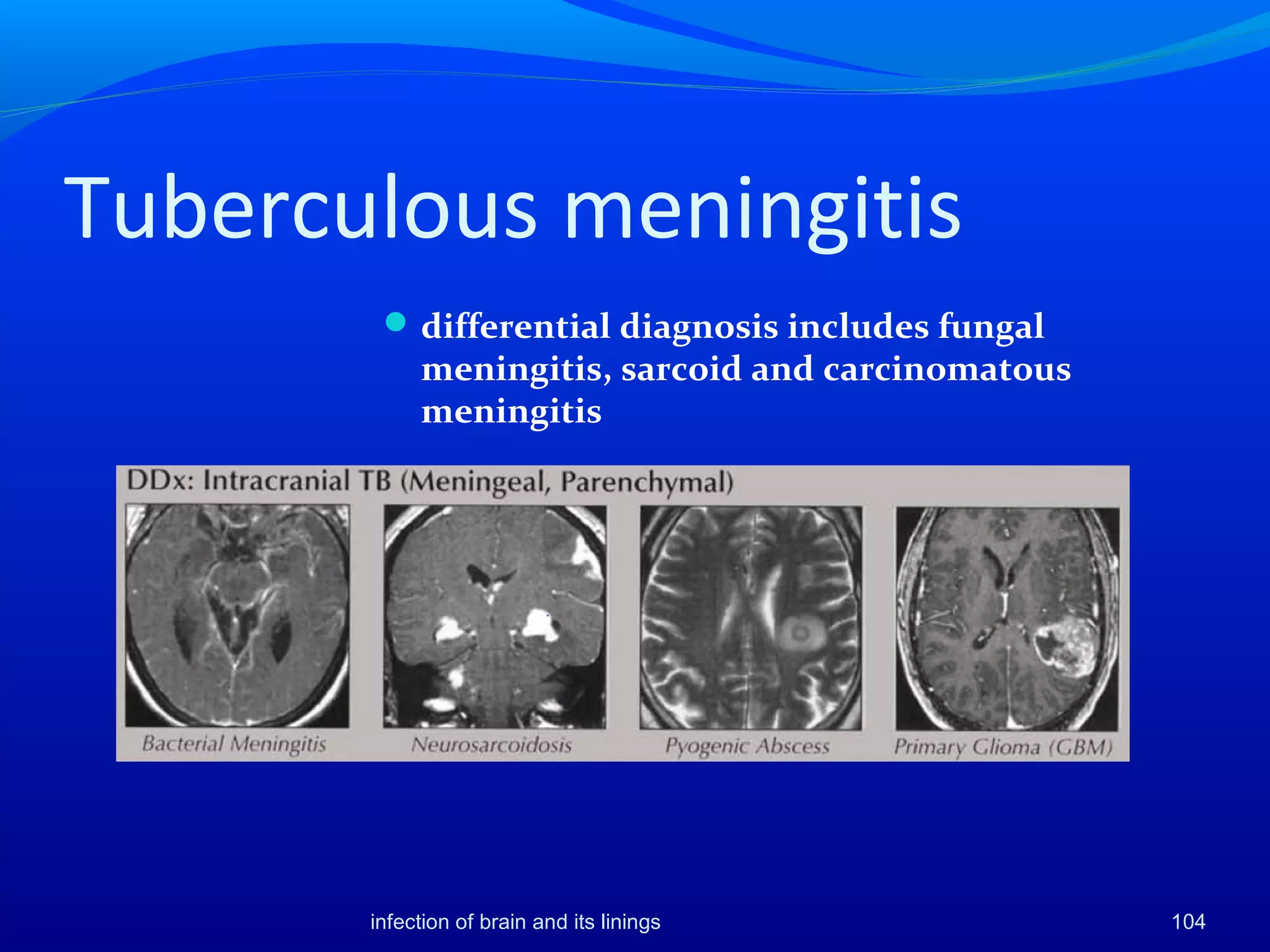 Tuberculous meningitis
differential diagnosis includes fungal
meningitis, sarcoid and carcinomatous
meningitis
104infection of brain and its linings
 