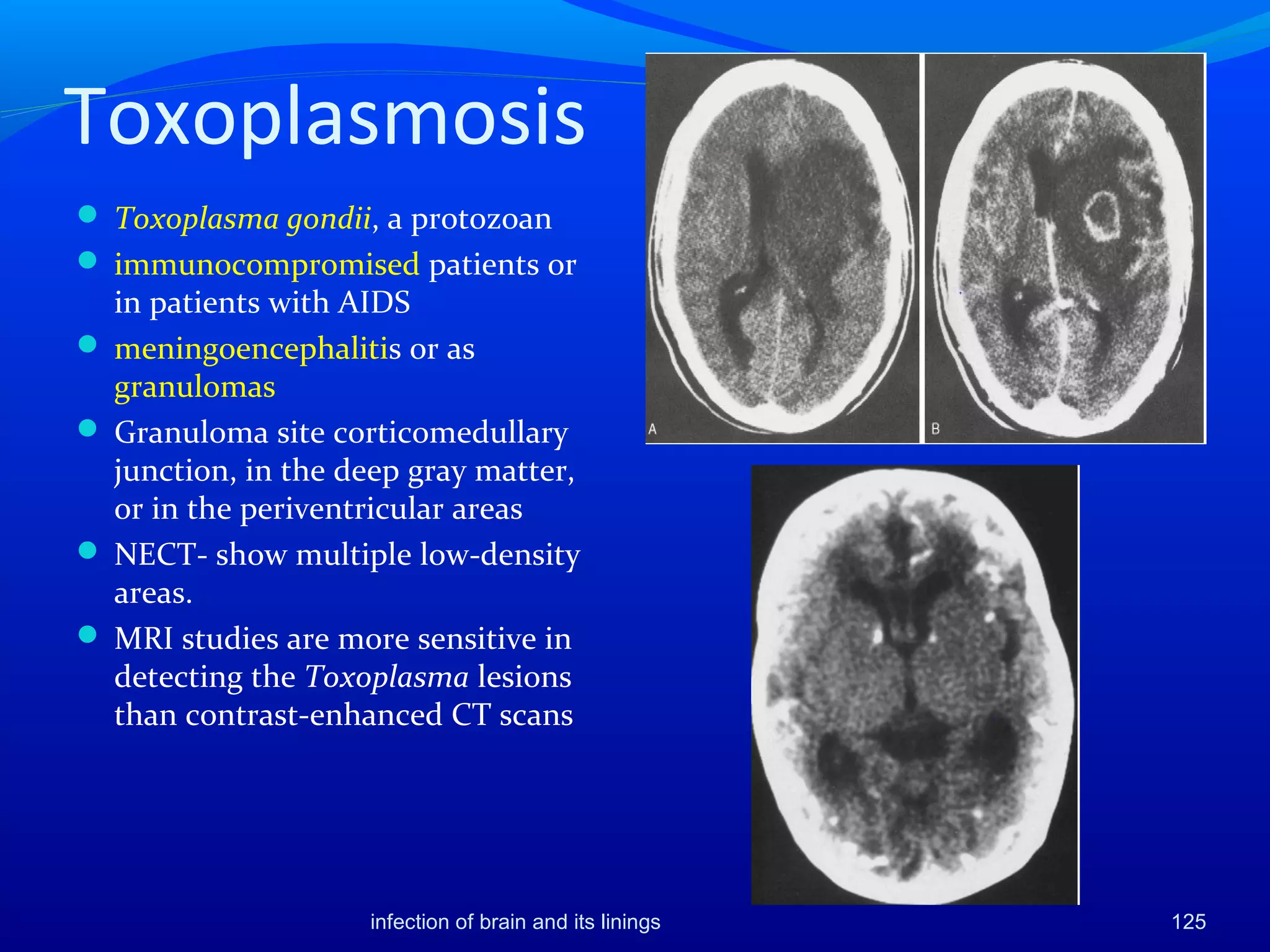 Toxoplasmosis
 Toxoplasma gondii, a protozoan
 immunocompromised patients or
in patients with AIDS
 meningoencephalitis or as
granulomas
 Granuloma site corticomedullary
junction, in the deep gray matter,
or in the periventricular areas
 NECT- show multiple low-density
areas.
 MRI studies are more sensitive in
detecting the Toxoplasma lesions
than contrast-enhanced CT scans
infection of brain and its linings 125
 