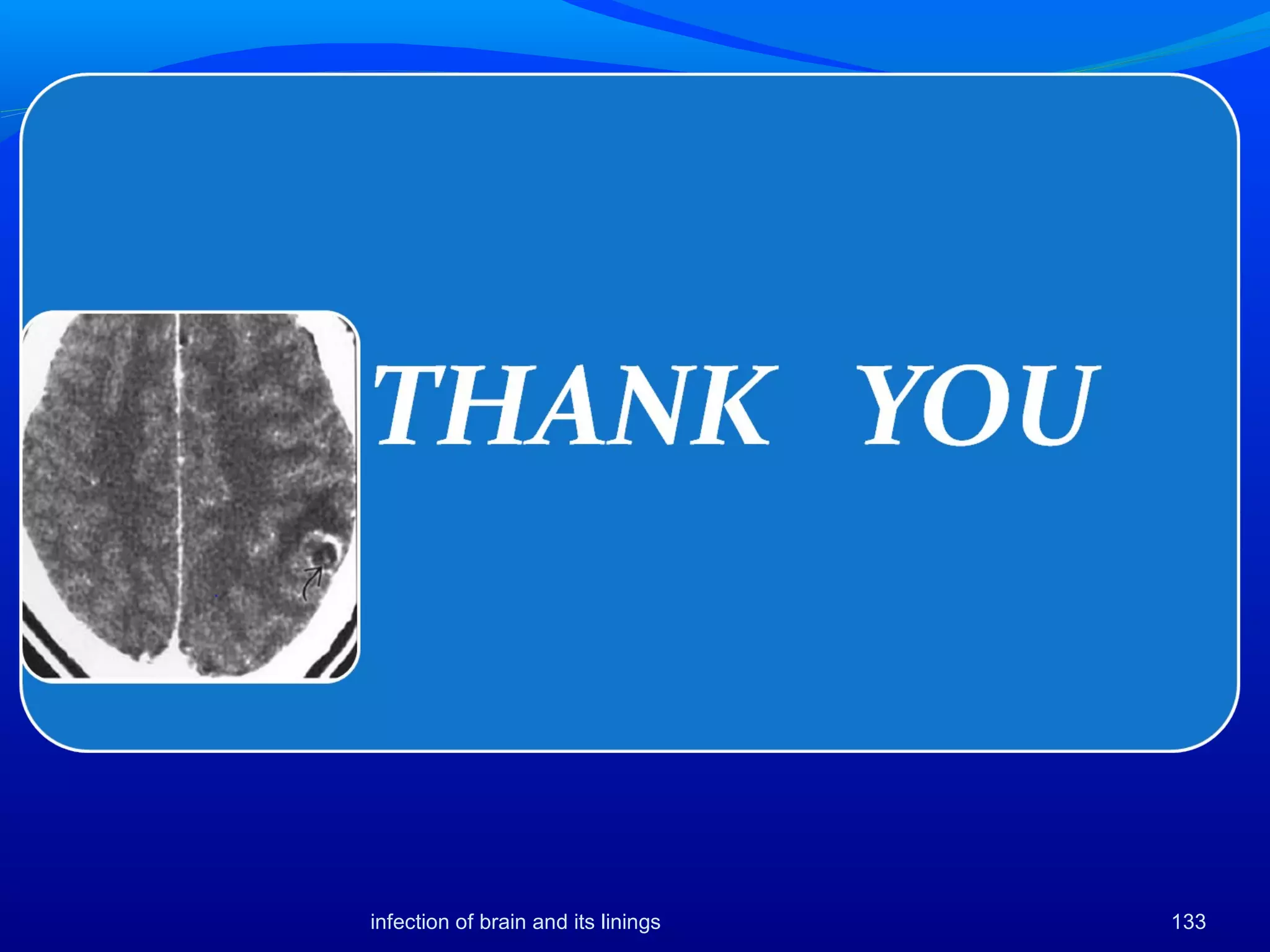 133infection of brain and its linings
 