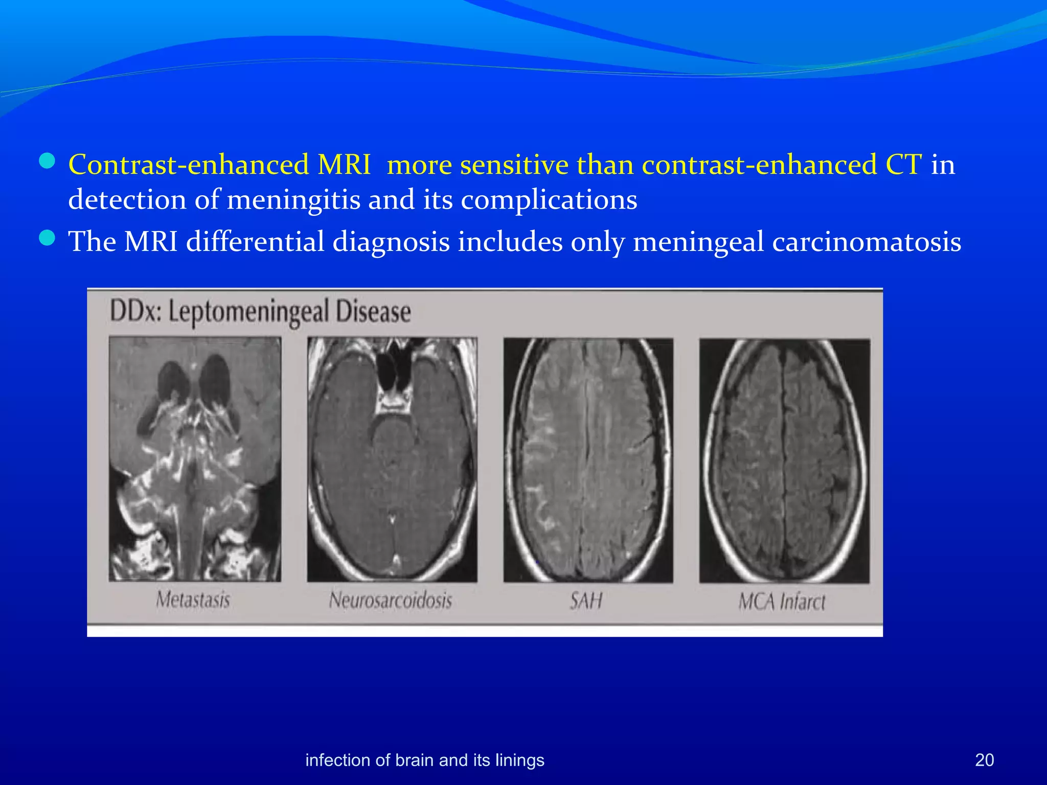 20
Contrast-enhanced MRI more sensitive than contrast-enhanced CT in
detection of meningitis and its complications
The MRI differential diagnosis includes only meningeal carcinomatosis
infection of brain and its linings
 