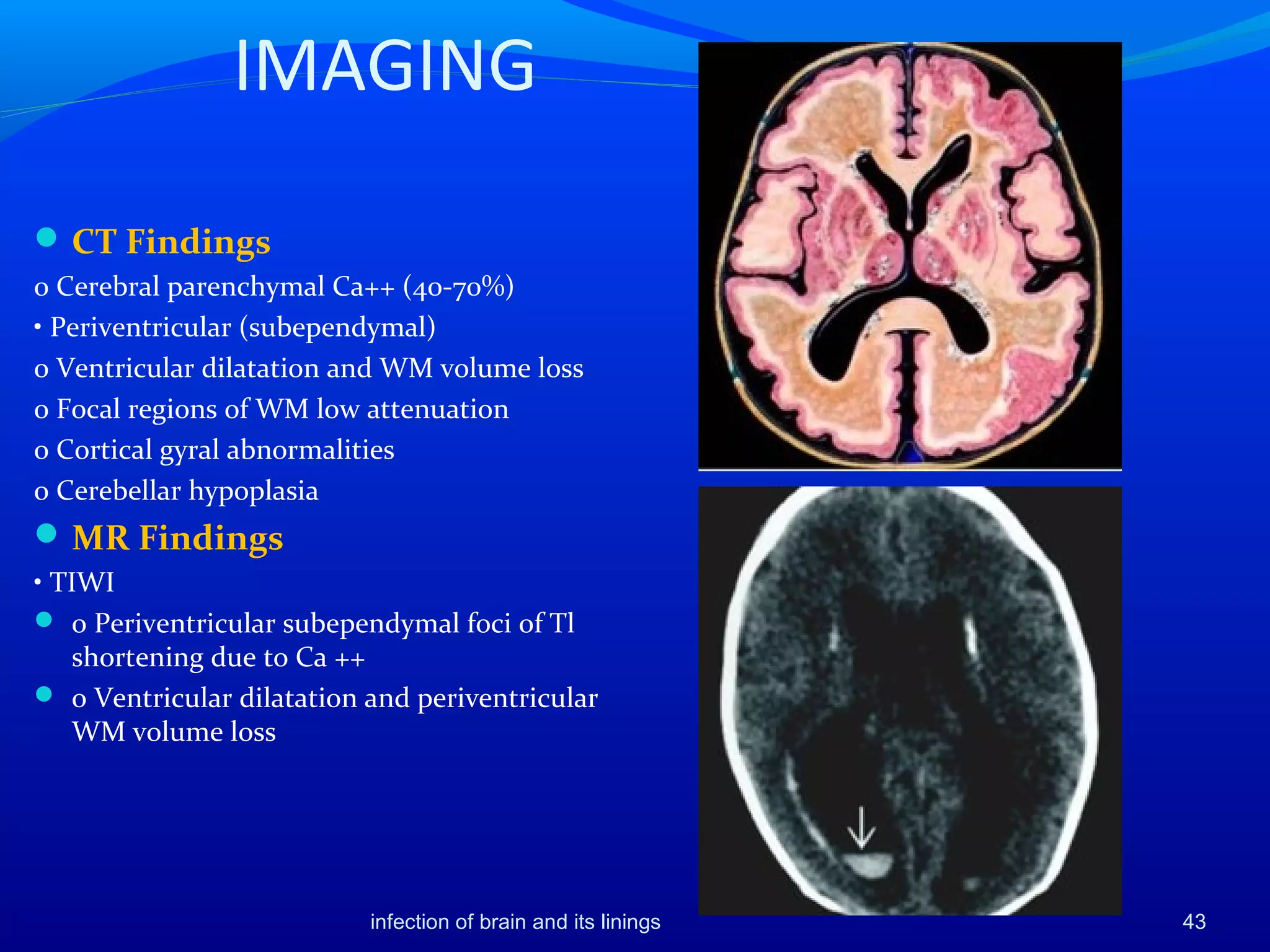 IMAGING
CT Findings
o Cerebral parenchymal Ca++ (40-70%)
• Periventricular (subependymal)
o Ventricular dilatation and WM volume loss
o Focal regions of WM low attenuation
o Cortical gyral abnormalities
o Cerebellar hypoplasia
MR Findings
• TIWI
 o Periventricular subependymal foci of Tl
shortening due to Ca ++
 o Ventricular dilatation and periventricular
WM volume loss
43infection of brain and its linings
 