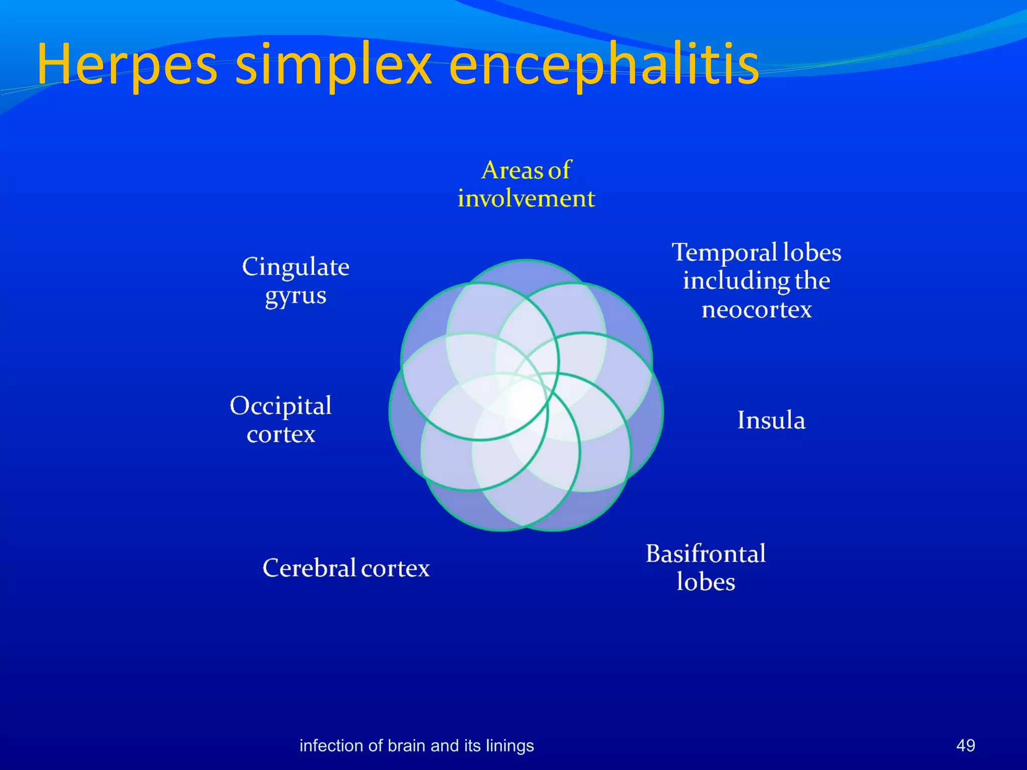 Herpes simplex encephalitis
49infection of brain and its linings
 