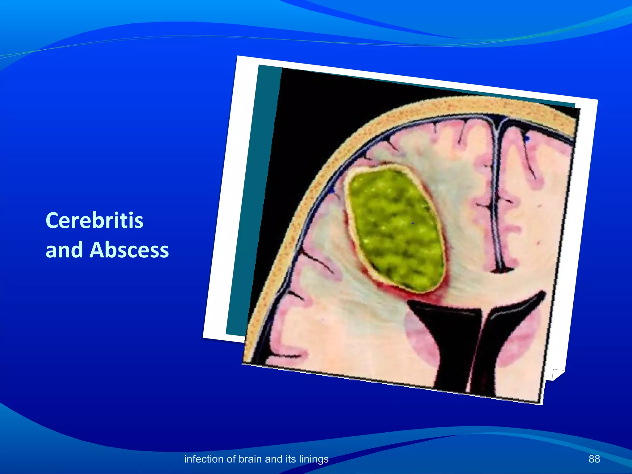 Cerebritis
and Abscess
88infection of brain and its linings
 