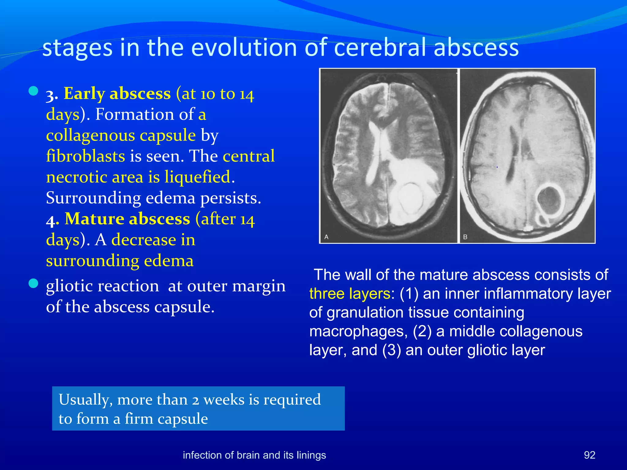 stages in the evolution of cerebral abscess
3. Early abscess (at 10 to 14
days). Formation of a
collagenous capsule by
fibroblasts is seen. The central
necrotic area is liquefied.
Surrounding edema persists.
4. Mature abscess (after 14
days). A decrease in
surrounding edema
gliotic reaction at outer margin
of the abscess capsule.
infection of brain and its linings 92
Usually, more than 2 weeks is required
to form a firm capsule
The wall of the mature abscess consists of
three layers: (1) an inner inflammatory layer
of granulation tissue containing
macrophages, (2) a middle collagenous
layer, and (3) an outer gliotic layer
 