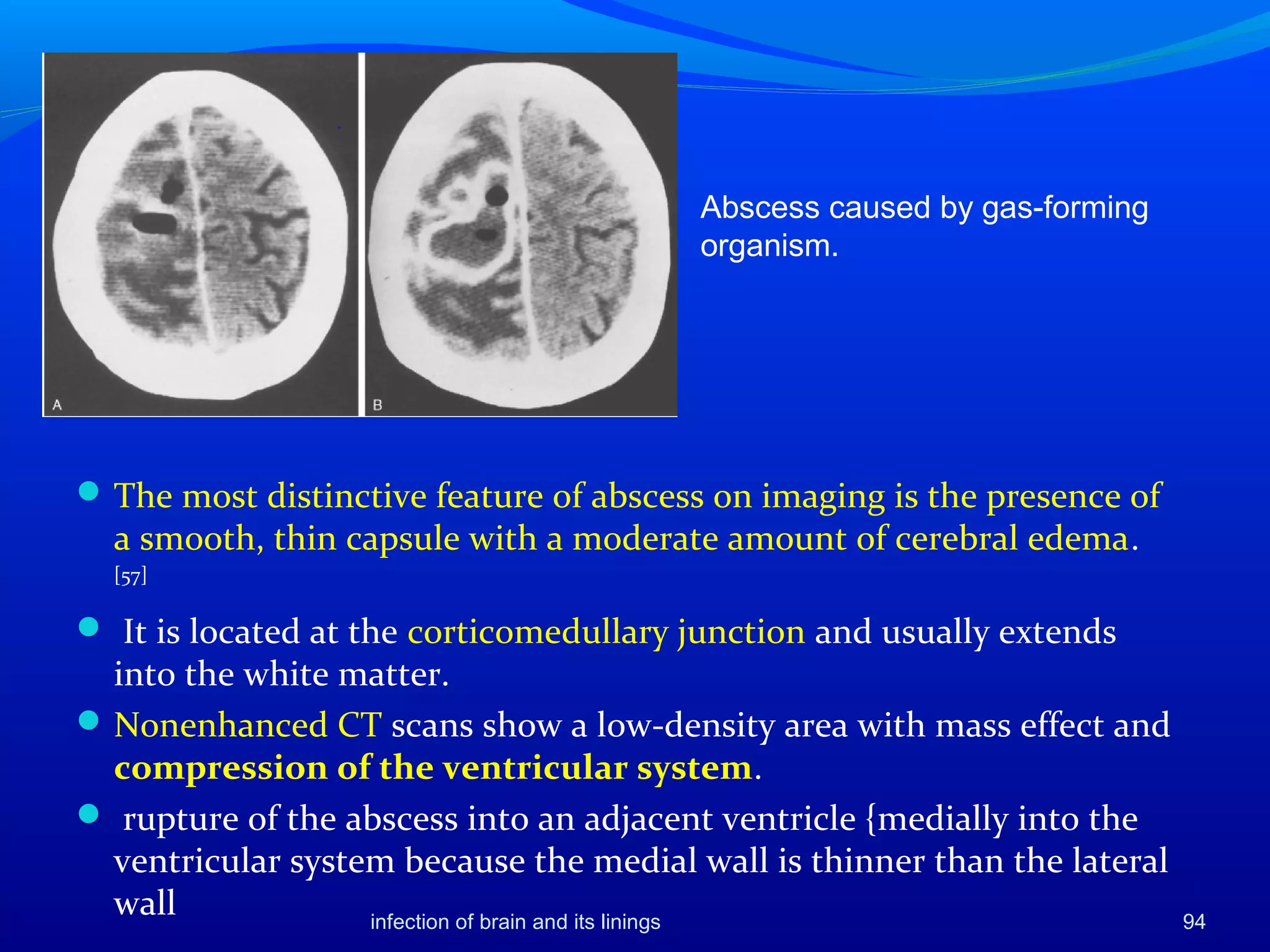 infection of brain and its linings 94
Abscess caused by gas-forming
organism.
The most distinctive feature of abscess on imaging is the presence of
a smooth, thin capsule with a moderate amount of cerebral edema.
[57]
 It is located at the corticomedullary junction and usually extends
into the white matter.
Nonenhanced CT scans show a low-density area with mass effect and
compression of the ventricular system.
 rupture of the abscess into an adjacent ventricle {medially into the
ventricular system because the medial wall is thinner than the lateral
wall
 