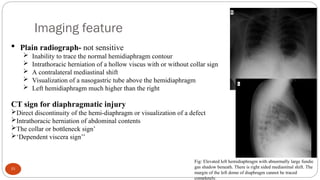 Imaging of injuries from abdominal Trauma draft.ppt