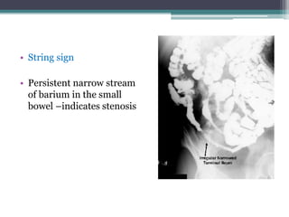 IMAGING OF INTESTINAL TUBERCULOSIS- CHANDRASHEKAR.pptx