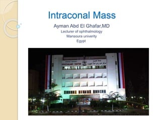 Intraconal Mass
Ayman Abd El Ghafar,MD
Lecturer of ophthalmology
Mansoura univerity
Egypt
 