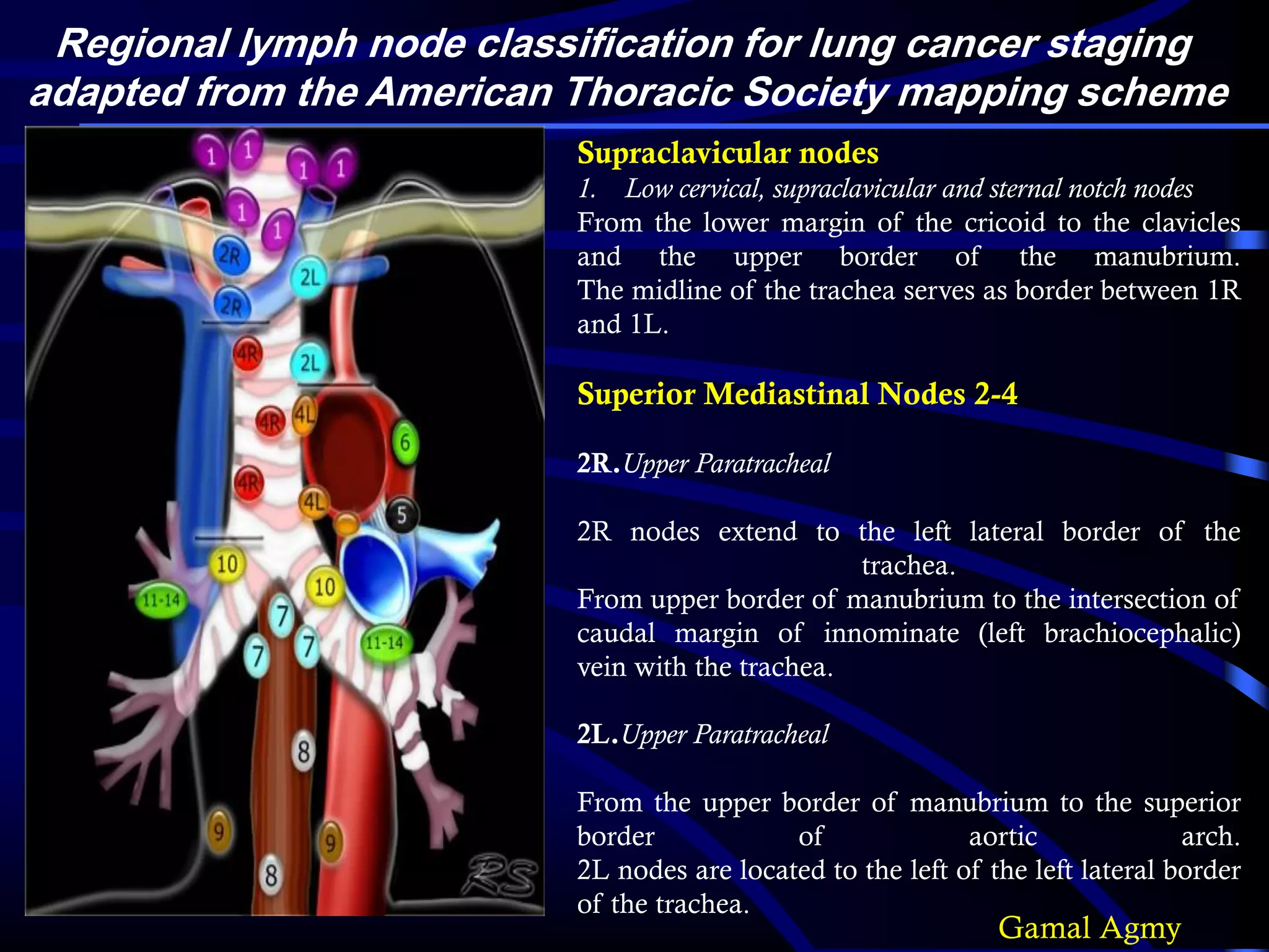 •
Regional lymph node classification for lung cancer staging
adapted from the American Thoracic Society mapping scheme
Supraclavicular nodes
1. Low cervical, supraclavicular and sternal notch nodes
From the lower margin of the cricoid to the clavicles
and the upper border of the manubrium.
The midline of the trachea serves as border between 1R
and 1L.
Superior Mediastinal Nodes 2-4
2R.Upper Paratracheal
2R nodes extend to the left lateral border of the
trachea.
From upper border of manubrium to the intersection of
caudal margin of innominate (left brachiocephalic)
vein with the trachea.
2L.Upper Paratracheal
From the upper border of manubrium to the superior
border of aortic arch.
2L nodes are located to the left of the left lateral border
of the trachea.
Gamal Agmy
 