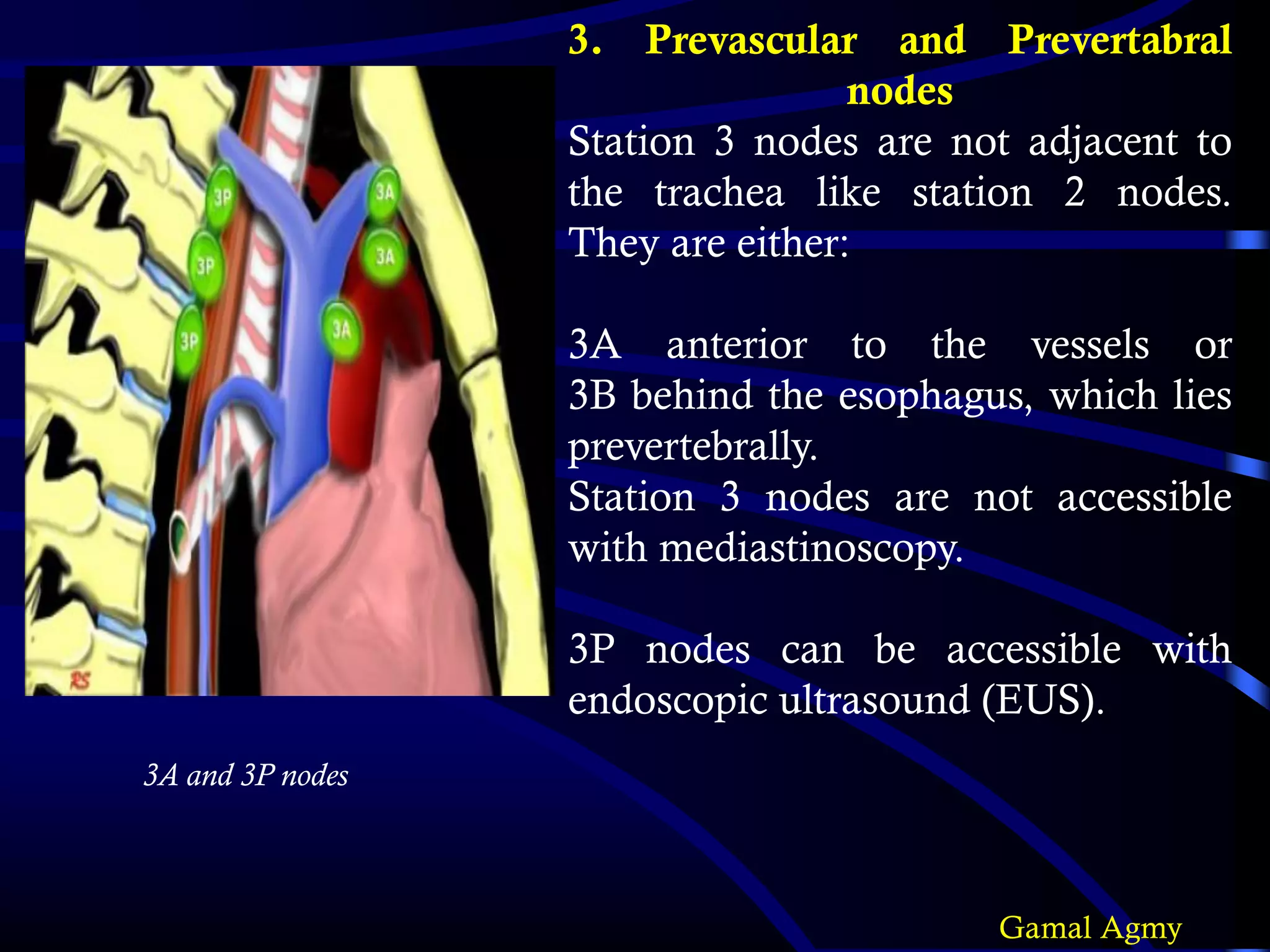 3. Prevascular and Prevertabral
nodes
Station 3 nodes are not adjacent to
the trachea like station 2 nodes.
They are either:
3A anterior to the vessels or
3B behind the esophagus, which lies
prevertebrally.
Station 3 nodes are not accessible
with mediastinoscopy.
3P nodes can be accessible with
endoscopic ultrasound (EUS).
3A and 3P nodes
Gamal Agmy
 