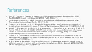 Imaging of Müllerian Duct Anomalies(MDAs).pptx