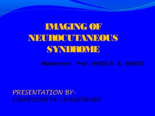 IMAGING OF
   NEUROCUTANEOUS
      SYNDROME
      Moderators: Prof. (HOD) R .K. GOGOI




PRESENTATION BY-
CHARUSMITA CHAUDHARY
 