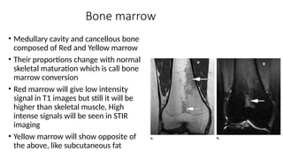 Marrow Conversion Pattern Comprehensive Imaging of Normal and Abnormal Skeletal Maturation in ...