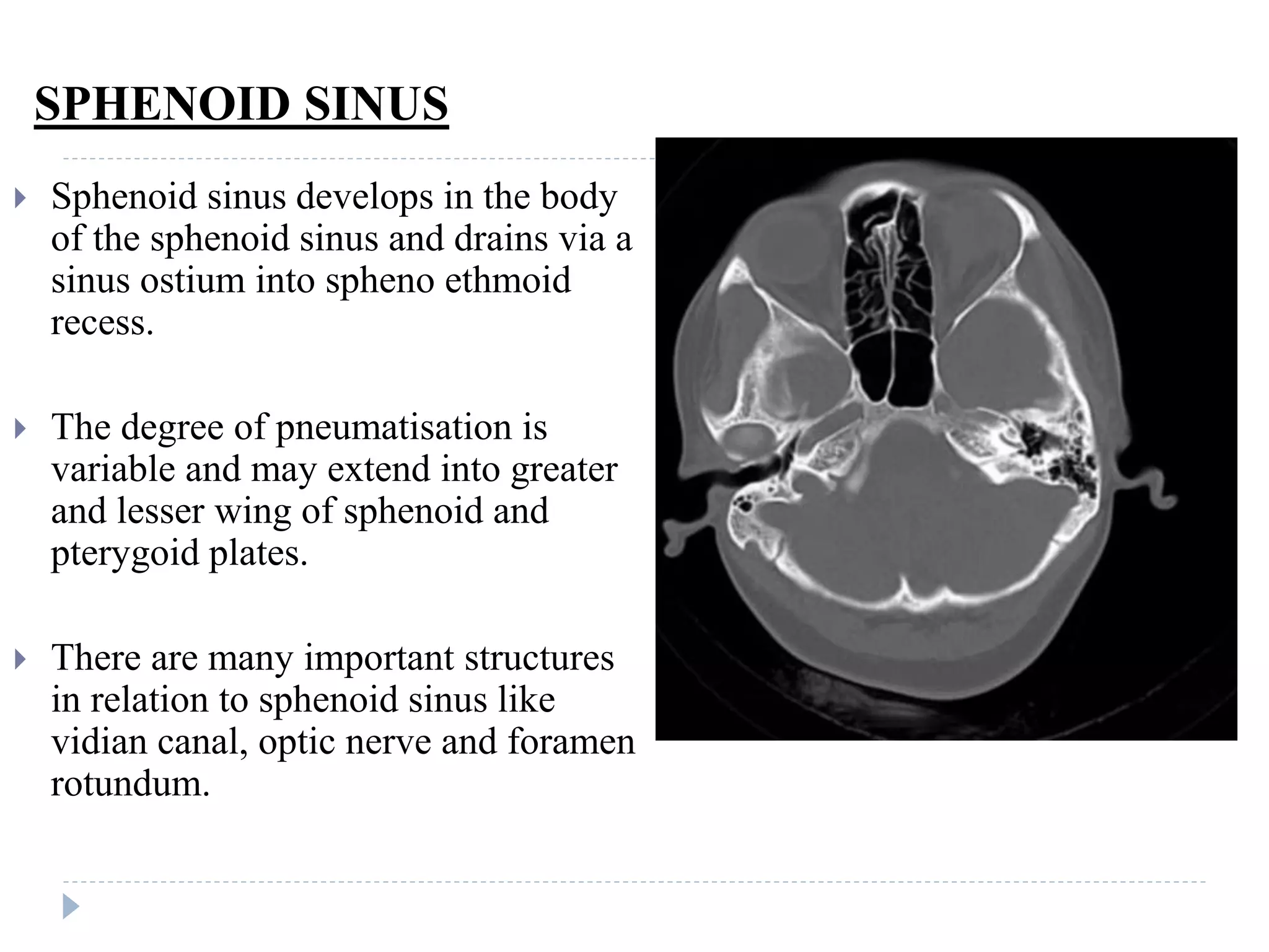 SPHENOID SINUS
 Sphenoid sinus develops in the body
of the sphenoid sinus and drains via a
sinus ostium into spheno ethmoid
recess.
 The degree of pneumatisation is
variable and may extend into greater
and lesser wing of sphenoid and
pterygoid plates.
 There are many important structures
in relation to sphenoid sinus like
vidian canal, optic nerve and foramen
rotundum.
 