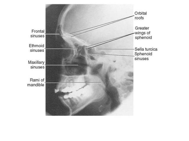 active directory users and computers windows 11 bitlocker tab missing