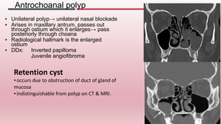 Imaging of paranasal sinuses (including anatomy and varaints)pk1 pdf  ppt