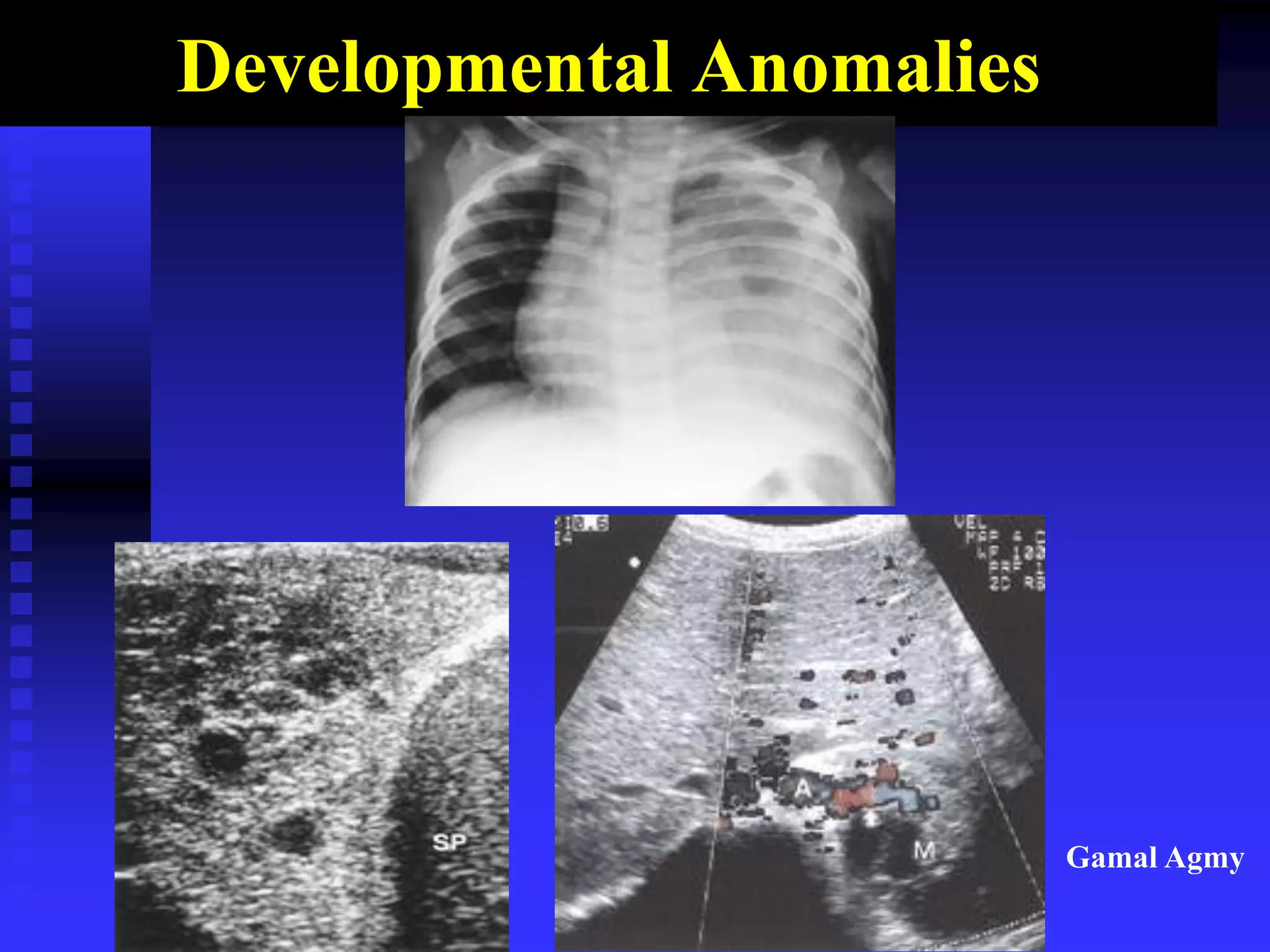 Developmental Anomalies
Gamal Agmy
 
