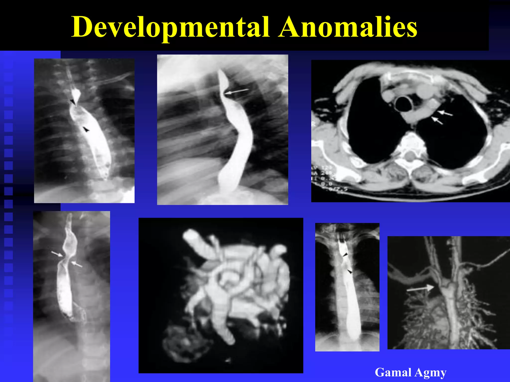 Developmental Anomalies
Gamal Agmy
 