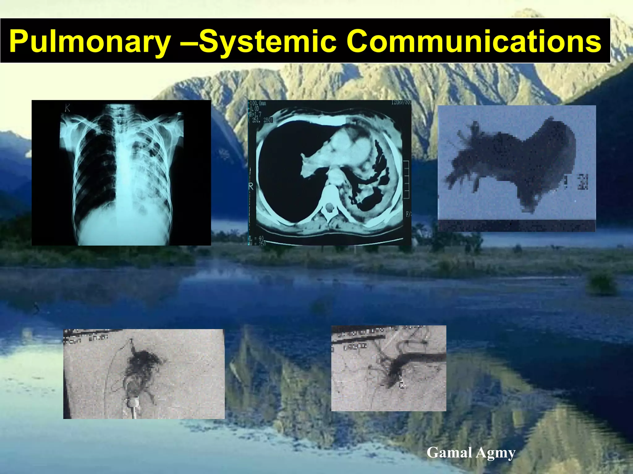 Pulmonary –Systemic Communications
Gamal Agmy
 