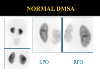 Lpo Radiography Imaging of renal hypertension | PPTX
