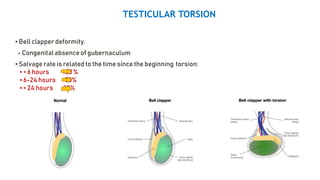 imaging of scrotum [Repaired] [Repaired].pptx
