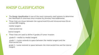 IMAGING OF SELLA AND SELLAR LESIONS MONICA.pptx